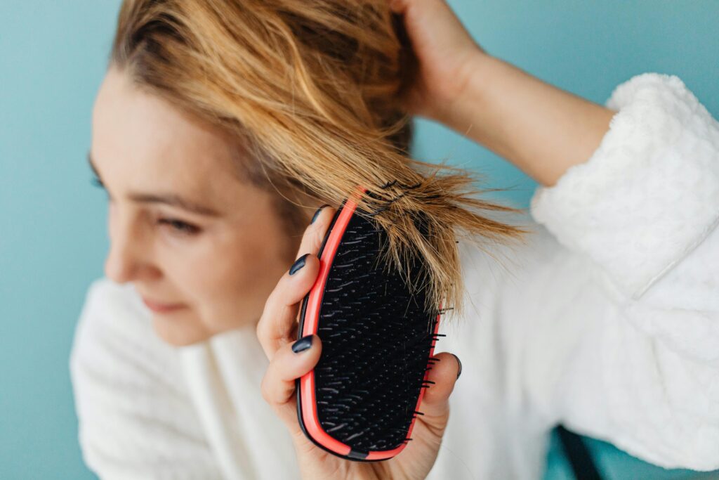 Dandruff on scalp not caused by dryness